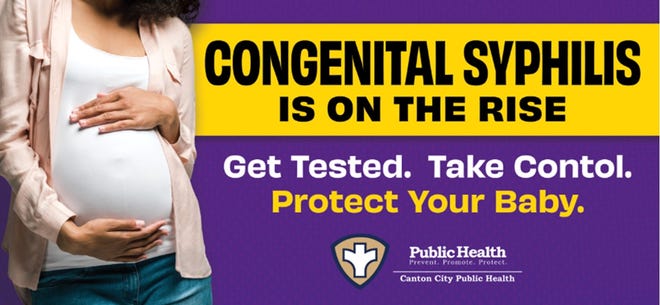 Canton City Public Health launched a billboard campaign to increase awareness of the dangers of congenital syphilis. Sexually transmitted infections increased with the onset of the COVID-19 pandemic.